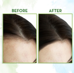 MAMAEARTH ROSEMARY ESSENTIAL OIL FOR HAIR GROWTH - 15 ML