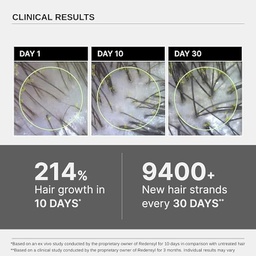 BARE ANATOMY ADVANCED HAIR GROWTH SERUM 30ML