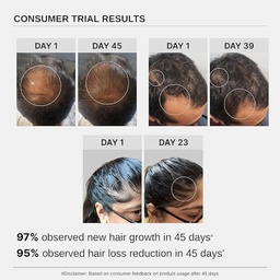 BARE ANATOMY ADVANCED HAIR GROWTH SERUM 30ML