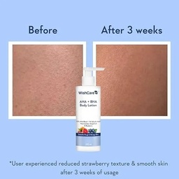 WISHCARE AHA + BHA BODY LOTION - 200ML