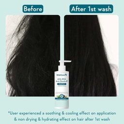 WISHCARE HYDRATING ABA BHA ANTI DANDRUFF SHAMPOO - 250ML
