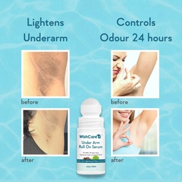 WISHCARE UNDER ARM ROLL ON SERUM - 50ML