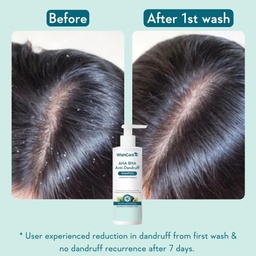 WISHCARE HYDRATING ABA BHA ANTI DANDRUFF SHAMPOO - 250ML