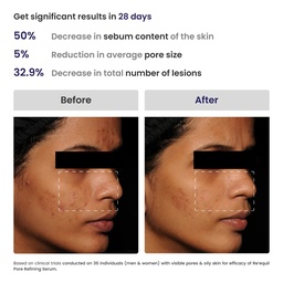 RE'EQUIL PORE REFINING 5% NIACINAMIDE SERUM 25ML