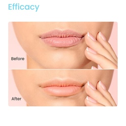 EARTH RHYTHM FABULIPS VITAMIN C & HYALURONIC ACID LIP BALM 5G